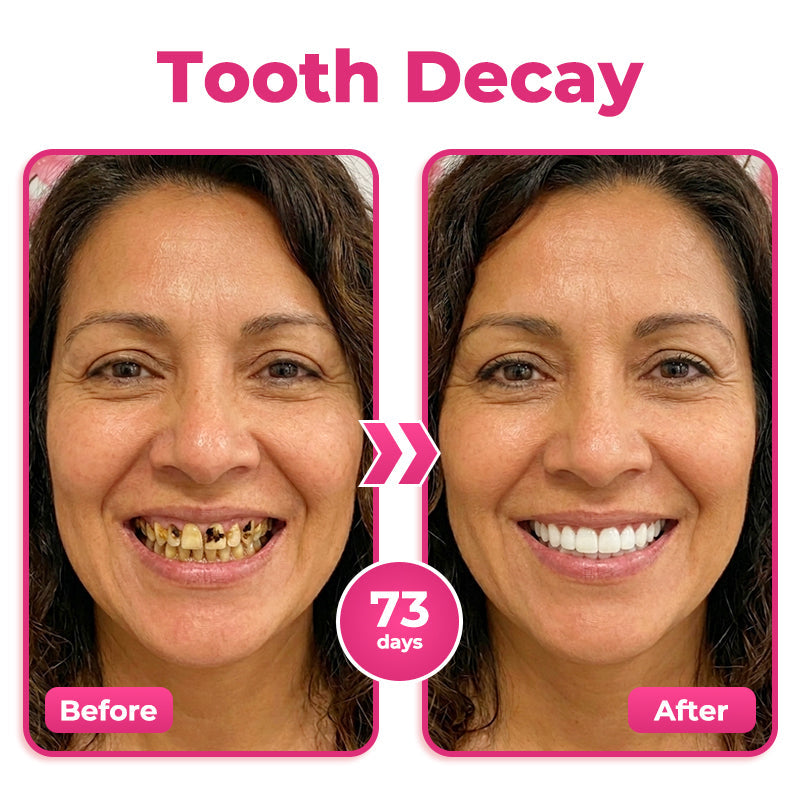 🇬🇧 🦷 🌟 Natravor® Thismile NH-10 Toothpaste Serum for Enamel & Gum Care – Advanced Therapypy