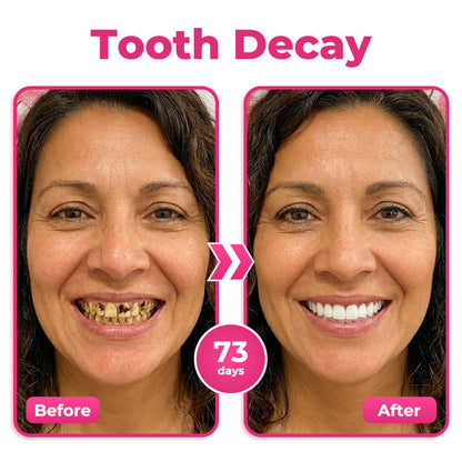 🇬🇧 🦷 🌟 Natravor® Thismile NH-10 Toothpaste Serum for Enamel & Gum Care – Advanced Therapypy