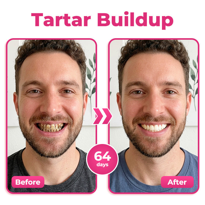 🇬🇧 🦷 🌟 Natravor® Thismile NH-10 Toothpaste Serum for Enamel & Gum Care – Advanced Therapypy