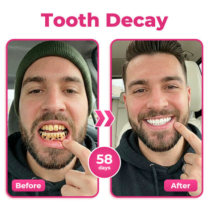 🇬🇧 🦷 🌟 Natravor® Thismile NH-10 Toothpaste Serum for Enamel & Gum Care – Advanced Therapypy