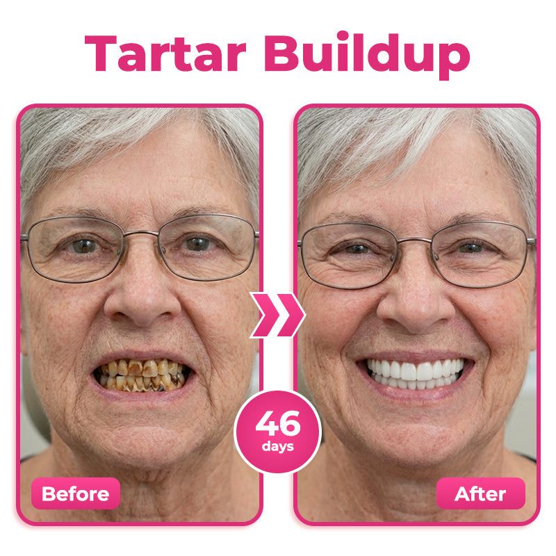🇬🇧 🦷 🌟 Natravor® Thismile NH-10 Toothpaste Serum for Enamel & Gum Care – Advanced Therapypy