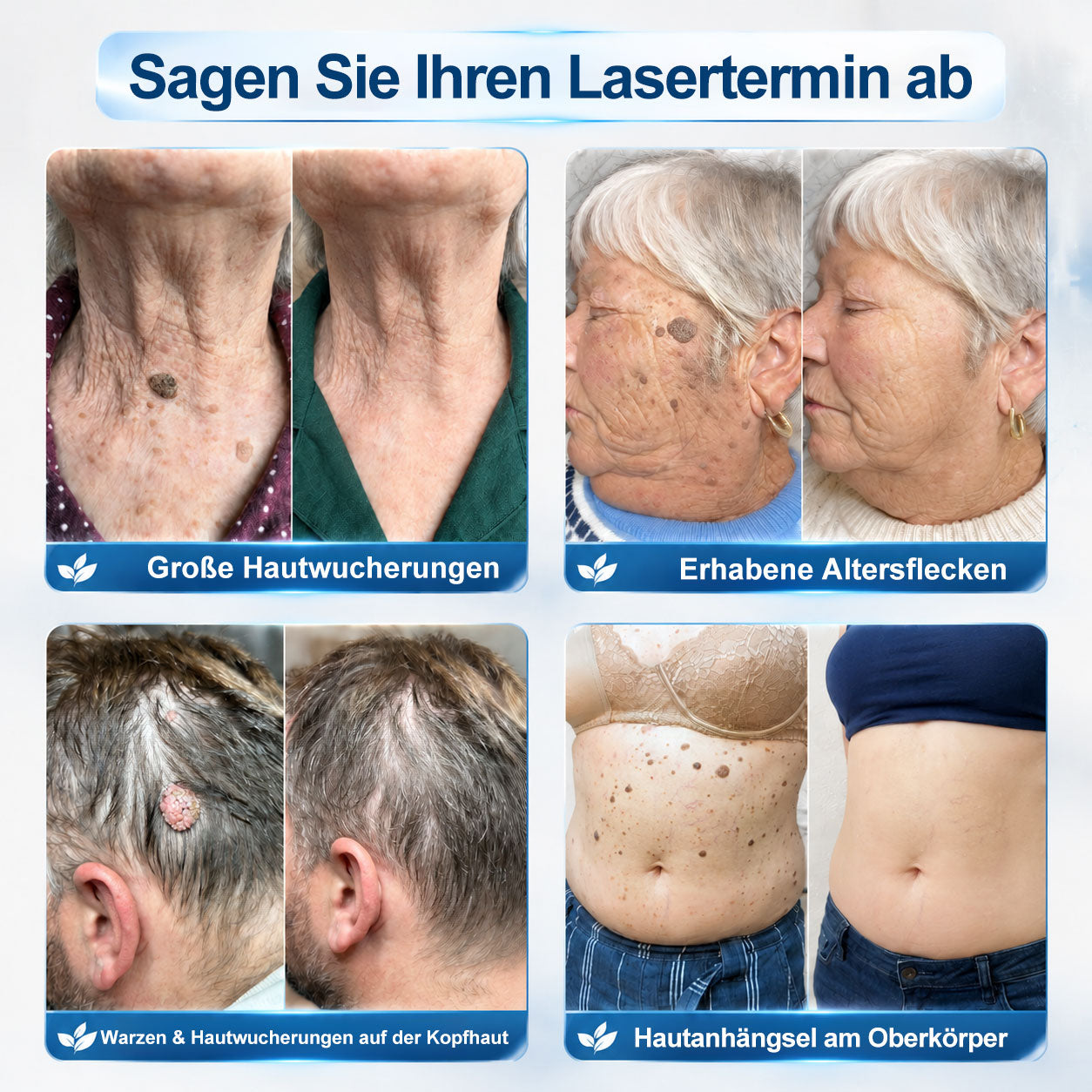 Offizieller Markenstore |✅𝑷𝑖𝒄𝐝𝐨® 7-𝑻𝒂𝒈𝒆 𝑯𝒂𝒖𝒕𝒂𝒏𝒉ä𝒏𝒈𝒔𝒆𝒍- & 𝑭𝒍𝒆𝒄𝒌𝒆𝒏𝒆𝒏𝒕𝒇𝒆𝒓𝒏𝒆𝒓(Schmerzfreier Rollerball – Keine Narbenbildung)🌺