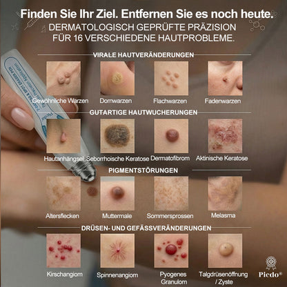 Offizieller Markenstore |✅𝑷𝑖𝒄𝐝𝐨® 7-𝑻𝒂𝒈𝒆 𝑯𝒂𝒖𝒕𝒂𝒏𝒉ä𝒏𝒈𝒔𝒆𝒍- & 𝑭𝒍𝒆𝒄𝒌𝒆𝒏𝒆𝒏𝒕𝒇𝒆𝒓𝒏𝒆𝒓(Schmerzfreier Rollerball – Keine Narbenbildung)🌺