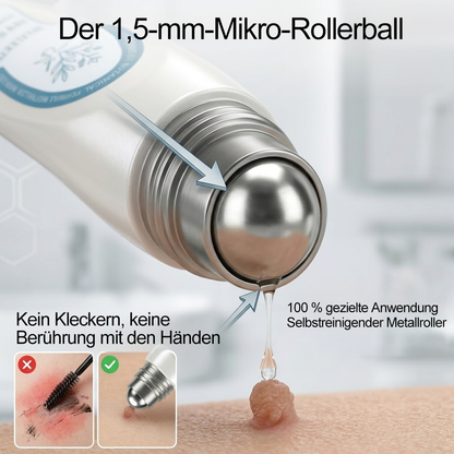 Offizieller Markenstore |✅𝑷𝑖𝒄𝐝𝐨® 7-𝑻𝒂𝒈𝒆 𝑯𝒂𝒖𝒕𝒂𝒏𝒉ä𝒏𝒈𝒔𝒆𝒍- & 𝑭𝒍𝒆𝒄𝒌𝒆𝒏𝒆𝒏𝒕𝒇𝒆𝒓𝒏𝒆𝒓(Schmerzfreier Rollerball – Keine Narbenbildung)🌺